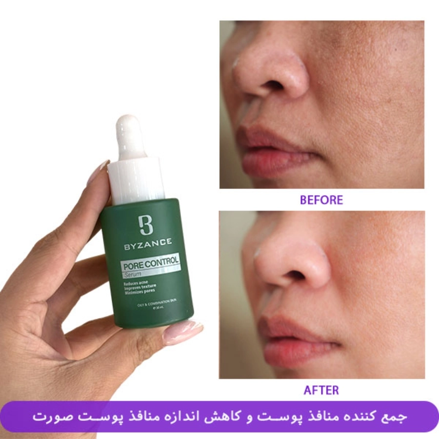 سرم ترکیبی کوچک کننده منافذ بیزانس