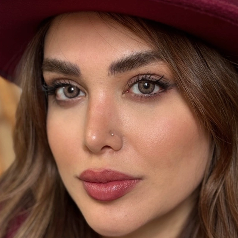 لنز آلیس براون rose