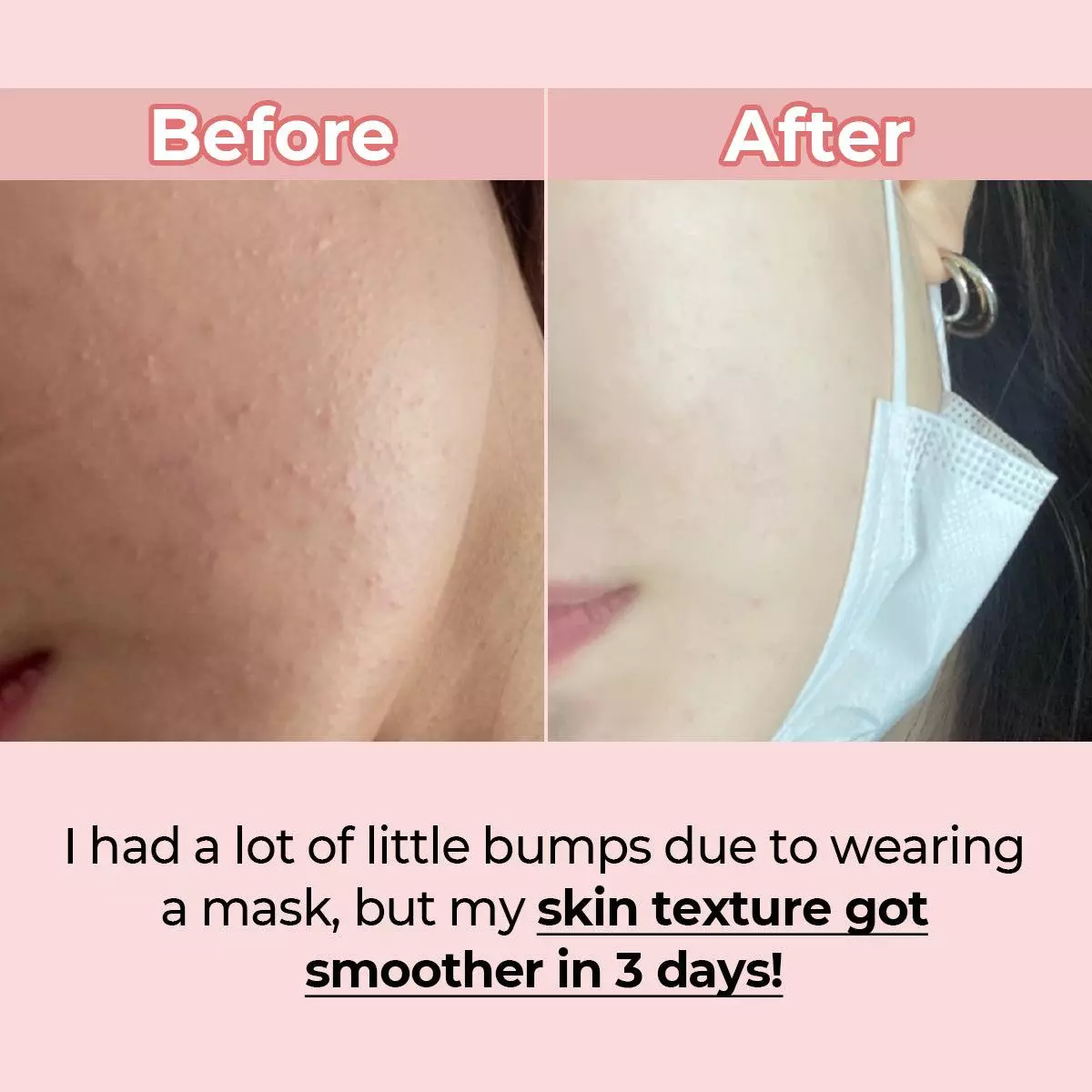 سرم نامبوزین شماره 3 نرم کننده و ابرسان پوست