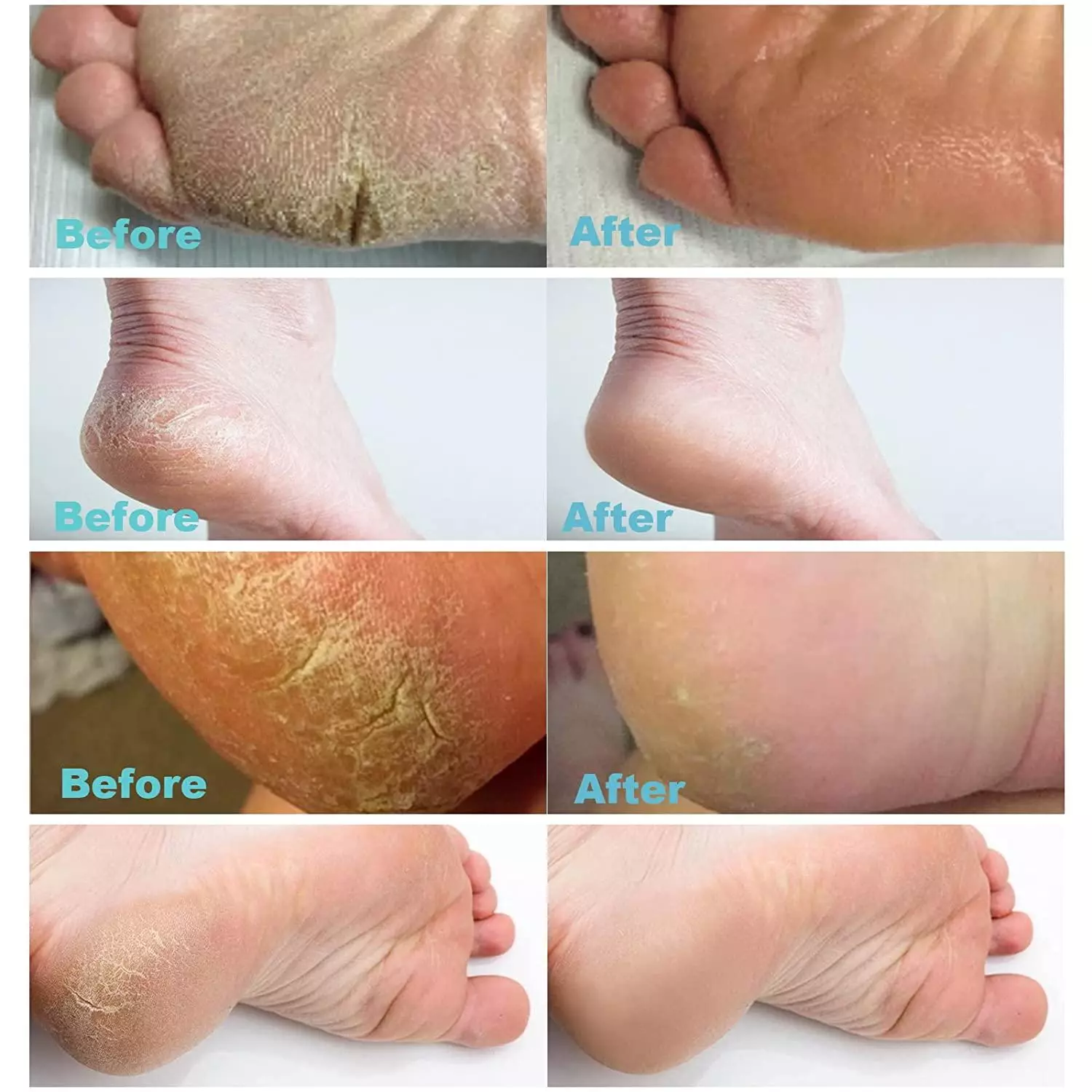 کرم ترک پا گیاهی برند هاید