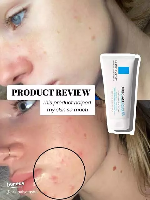 کرم ترمیم کننده سیکاپلاست لاروش پوزای 100 میل LA ROCHE POSAY CICAPLAST BAUME B5