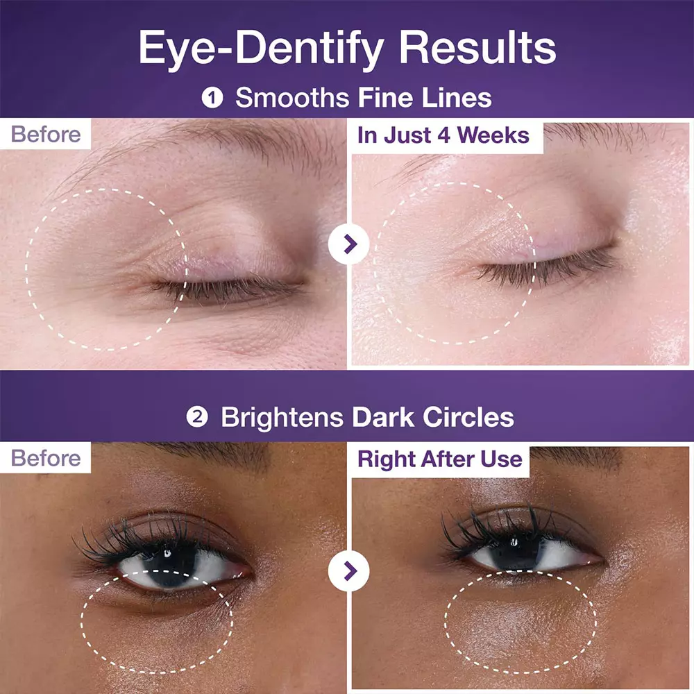 کرم دور چشم نامبوزین شماره 9 با ترکیب رتینول و NAD+