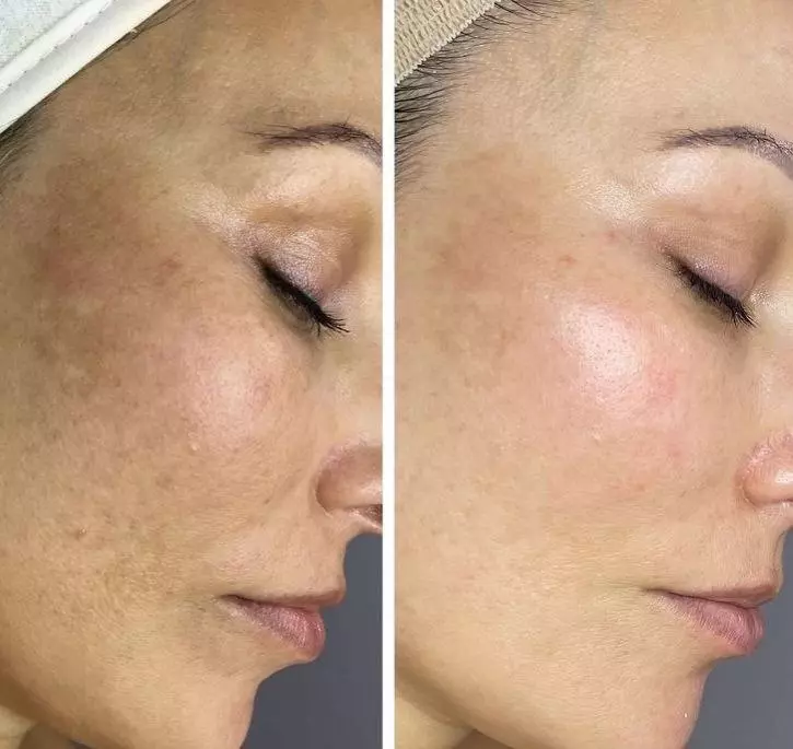 سرم نیاسینامید و روشن کننده آنوا مدل %Niacinamide 10% + TXA 4